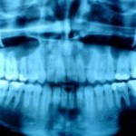 digital xrays grandview corners dental